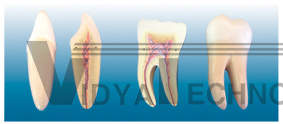 The expansion model of teeth